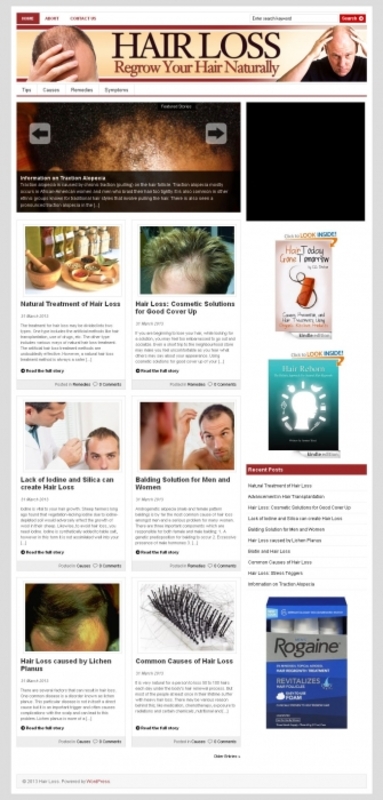 Product picture Hair Loss PLR Niche Blog 